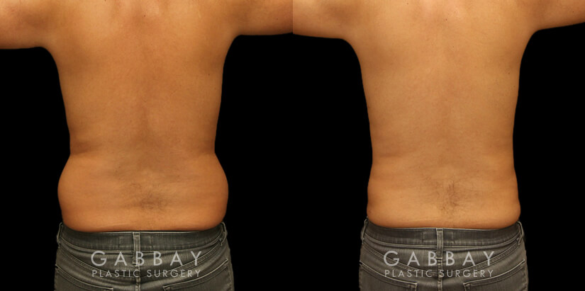 Male Waist, Sides and Flanks