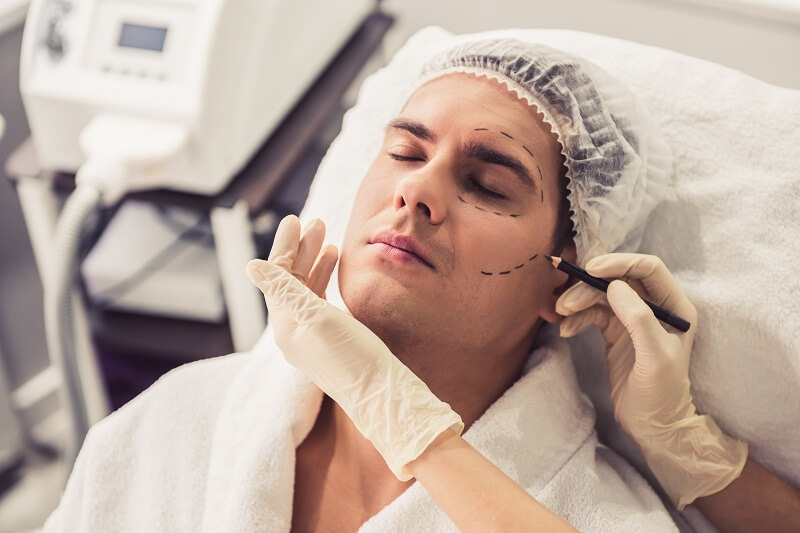 patient in chair doctor drawing dotted lines around eye and cheek