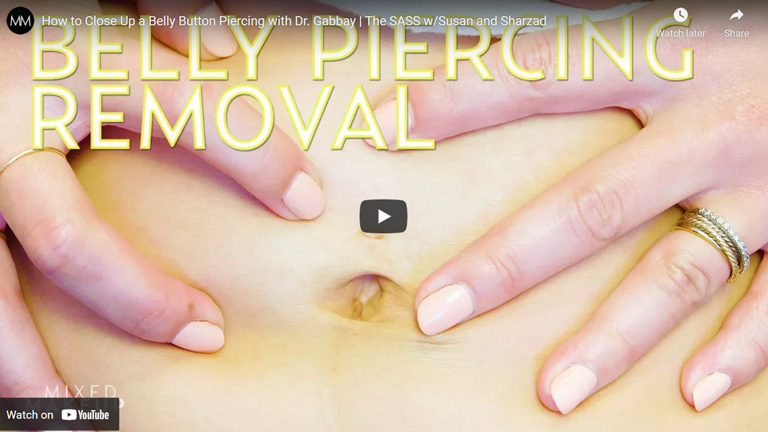 Image of How to Close Up a Belly Button Piercing with Dr. Gabbay Click to See Video